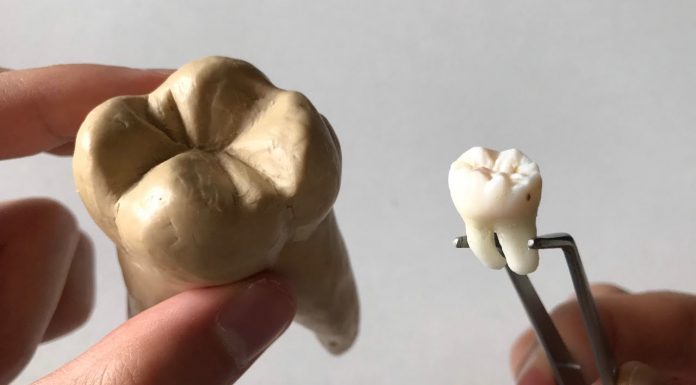 Сложности и противопоказания художественной реставрации зубов maxresdefault